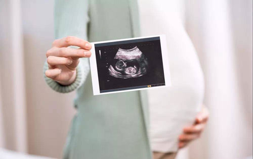 生育保險(xiǎn)待遇調(diào)整的通知